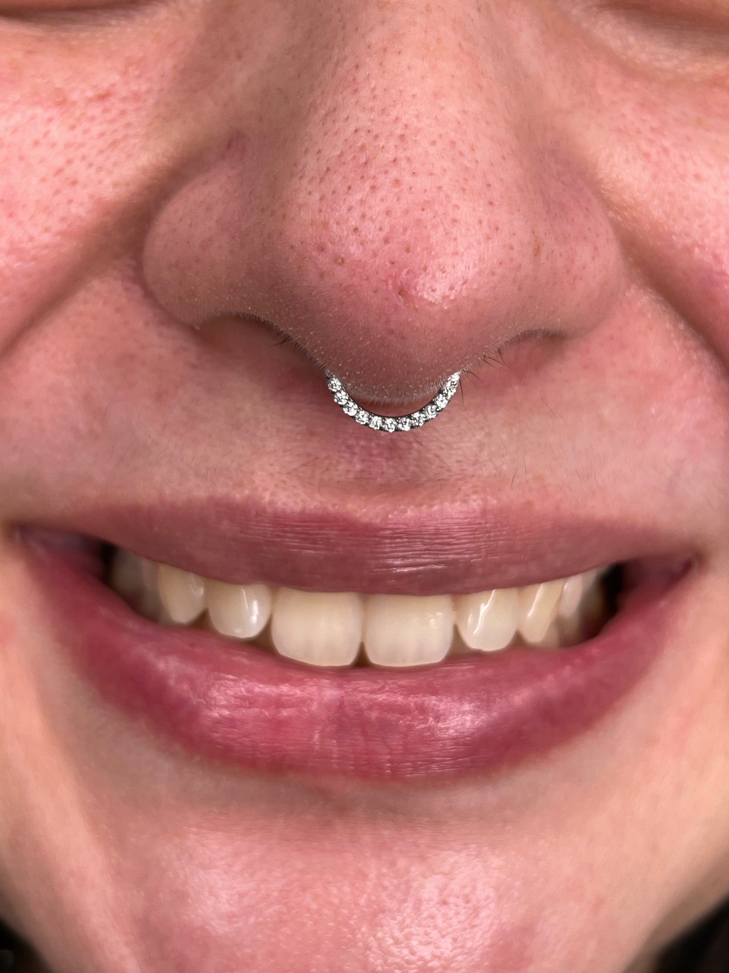 Segment  zircon frontal